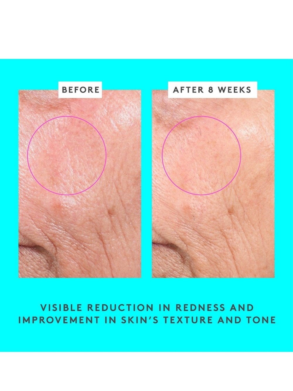 Drunk Elephant Bouncy Brightfacial Masque  with Azelaic and Salicylic Acid - Picture 4 of 6